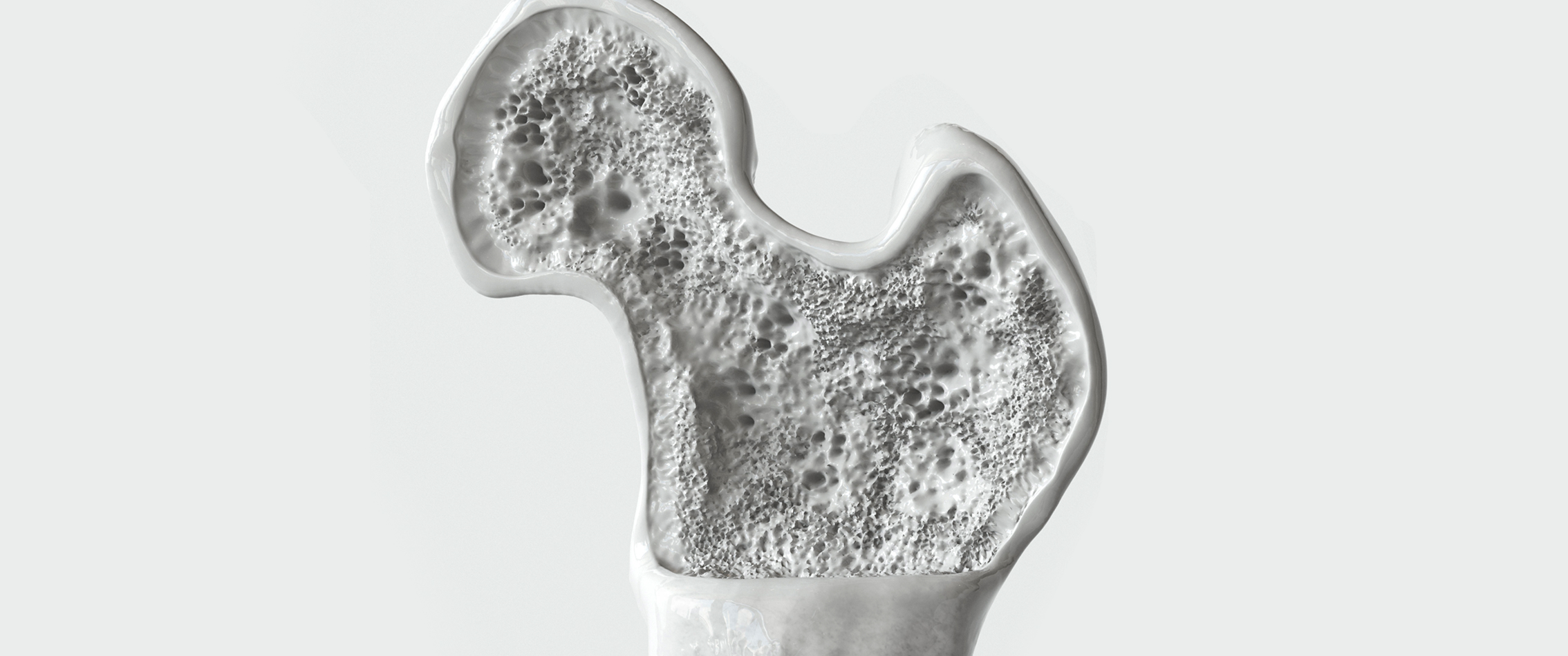 Illustration of healthy bone structure